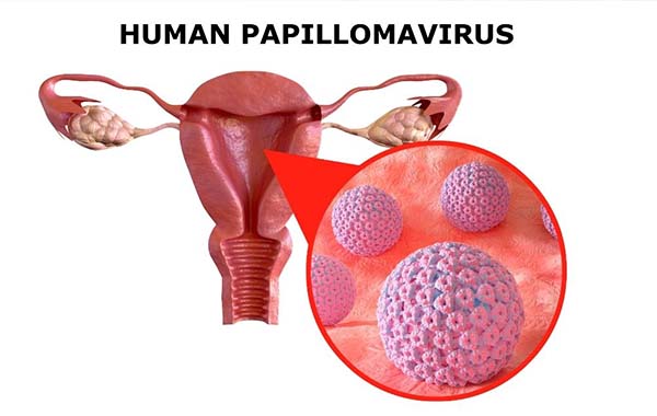HPV virüs